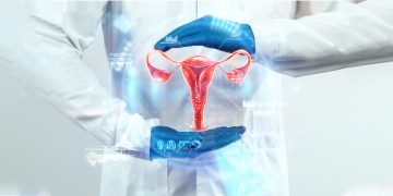 LE CANCER DU COL DE L’UTERUS