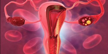 LA PROSTATE CHEZ LA FEMME