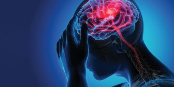 Les AVC : Accidents Vasculaires Cérébraux