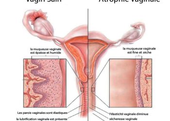 Ménopause : Comment aborder cette étape en douceur ?
