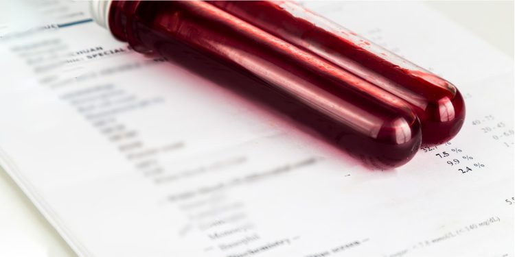 LES MALADIES SEXUELLEMENT TRANSMISSIBLES