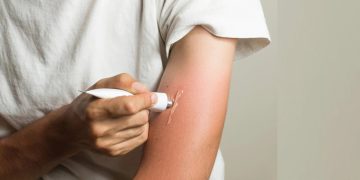 Comment soulager et guérir les brulures ?
