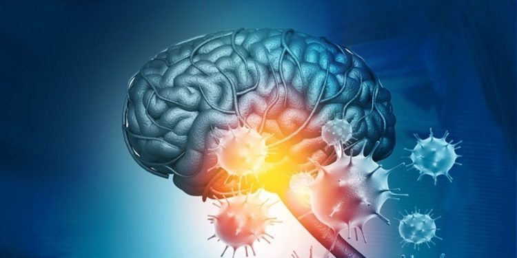 La Méningite Parmi Nous