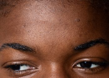 POINTS NOIRS : 10 masques qui font vraiment la différence
