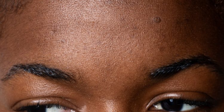 POINTS NOIRS : 10 masques qui font vraiment la différence