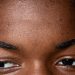 POINTS NOIRS : 10 masques qui font vraiment la différence